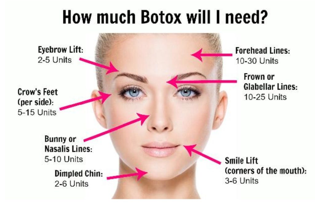 How Much Botox Will I Need? Acqua Blu Medical Spa