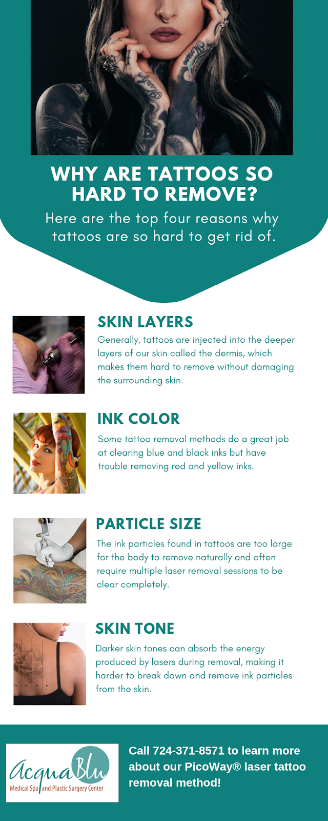 What is the Best Method of Tattoo Removal? - Acqua Blu Medical Spa