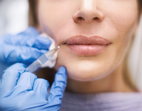 Woman getting lip injection.